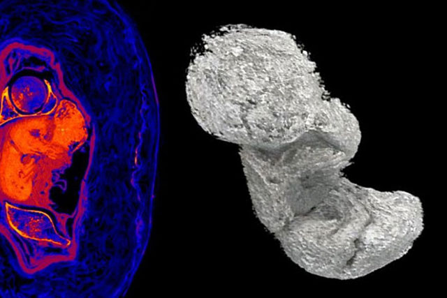 Thai nhi tự hóa xác ướp trong bụng nữ quý tộc Ai Cập 2.000 tuổi