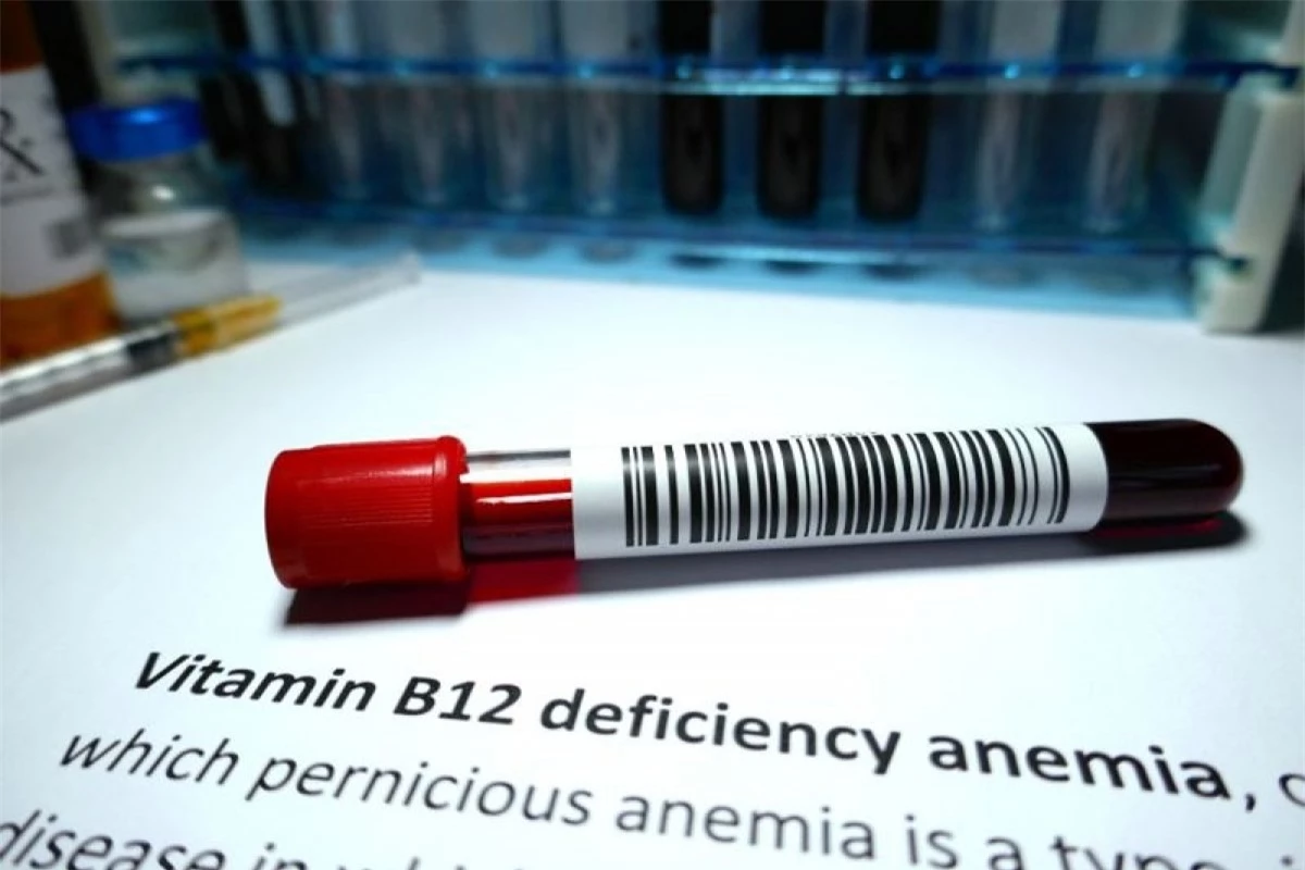 Thiếu vitamin B12: Vitamin B12 hỗ trợ quá trình trao đổi chất tế bào. Thiếu vitamin B12 có thể dẫn đến các triệu chứng như chóng mặt, loạn nhịp tim hoặc sưng đỏ lưỡi. Bạn cần bổ sung vitamin B12 qua thực phẩm và viên uống nếu gặp phải các triệu chứng này.