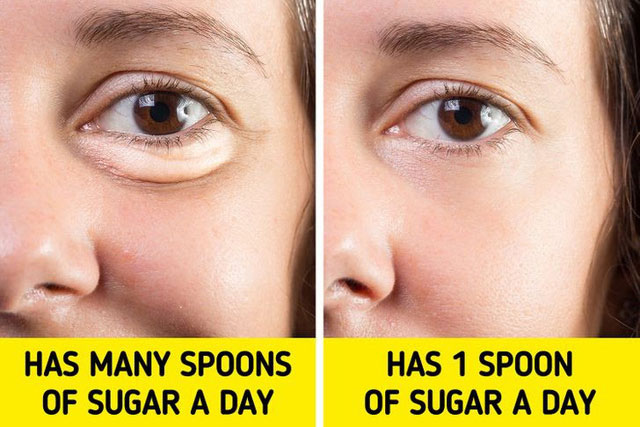 7 bí quyết “loại bỏ vĩnh viễn” tình trạng sưng mặt, bọng mắt và các bộ phận khác