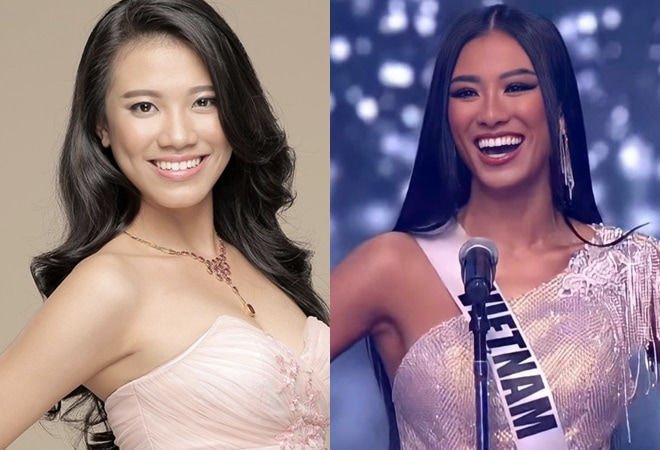 Những nàng Hậu thăng hạng nhờ chỉnh răng: Kim Duyên tỏa sáng, Đỗ Hà rạng rỡ hơn