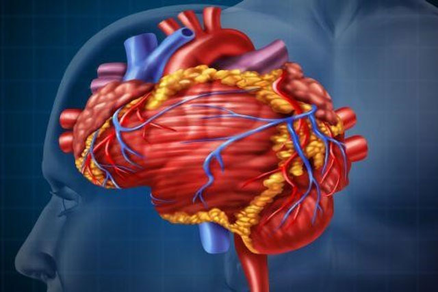 Cách phòng ngừa đột quỵ hiệu quả