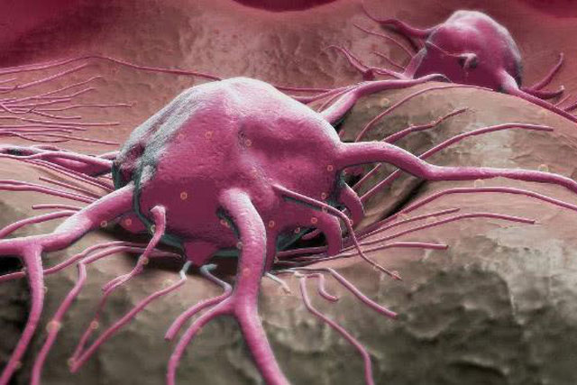 Không phân biệt là nam hay nữ, chỉ cần 2 bộ phận này "bốc mùi" thì 80% đã mắc bệnh ung thư dạ dày, cần tăng cường 4 món để dạ dày sạch khỏe