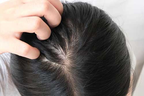 Dù là nam hay nữ, 4 vị trí này càng nhiều lông thì càng sống thọ, đặc biệt là cái đầu tiên