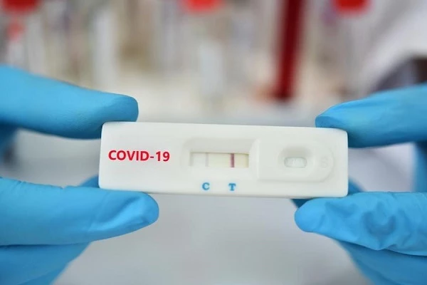 Tổng cục Hải quan cho biết, tổng kim ngạch nhập khẩu bộ test COVID-19 của Công ty Cổ phần Y tế Đức Minh trong 2 năm 2020 - 2021 là .437 tỷ đồng.