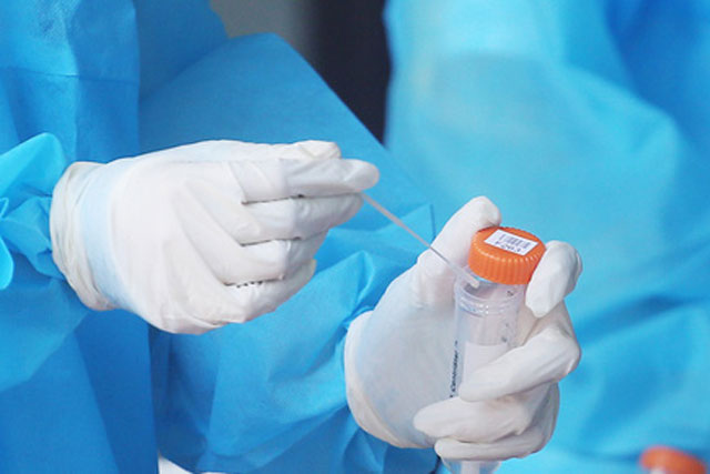 Ngày 22/2: Số mắc COVID-19 mới tăng vọt lên 55.879 ca; F0 tử vong giảm còn 77 ca