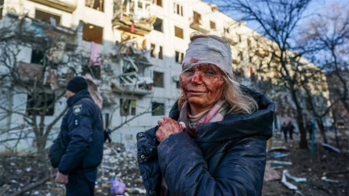 Một người phụ nữ bị thương khi Nga ồ ạt không kích vào thành phố Chuhuiv, Ukraine.