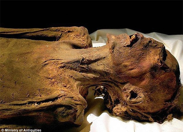 Bí ẩn “xác ướp hoàng tử la hét” 3.000 tuổi với vẻ mặt đau đớn đến ám ảnh: Kết quả phân tích ADN tiết lộ câu chuyện bi thảm đằng sau - Ảnh 2.