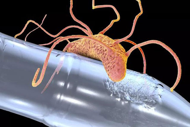 Vi khuẩn ăn nhựa, giải pháp xử lý ô nhiễm rác thải