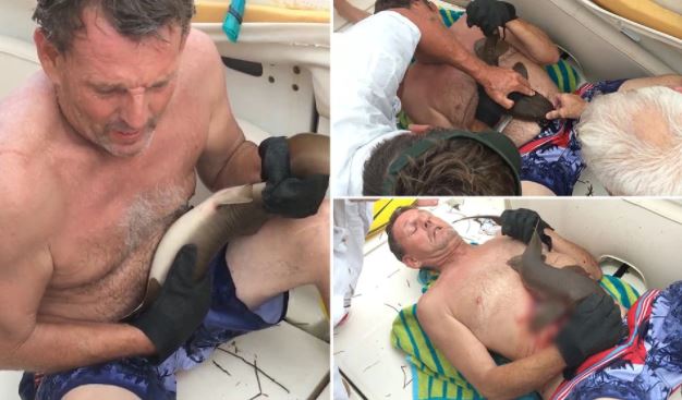 Người đàn ông bị 1 sinh vật bí ẩn cắn vào bụng, ngay cả cá voi, cá mập cũng ngao ngán!