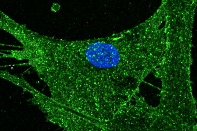 Biến da người phụ nữ 53 thành 23 tuổi nhờ kỹ thuật nhân bản cừu Dolly