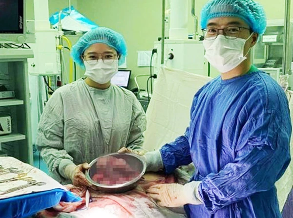 10 khối u xơ được các bác sĩ khoa Phụ sản Bệnh viện Đà Nẵng bóc tách từ tử cung nữ bệnh nhân 35 tuổi