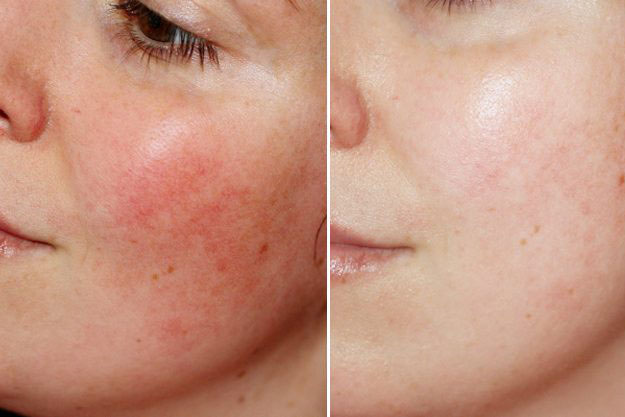 "Giải cứu" làn da sau những ngày trang điểm nhiều