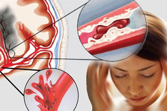 Bạn đã biết thực phẩm tốt cho người mỡ máu cao?