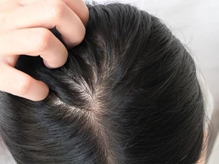 Bạn đã biết tại sao tóc ngày càng mỏng?