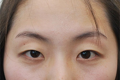 Sai lầm khiến lông mi nhanh gãy rụng