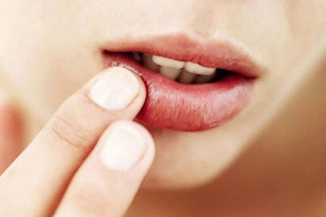 Nguyên nhân gây khô môi và cách khắc phục hiệu quả nhất