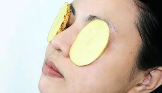 Đánh tan thâm quầng mắt chỉ bằng lát khoai tây