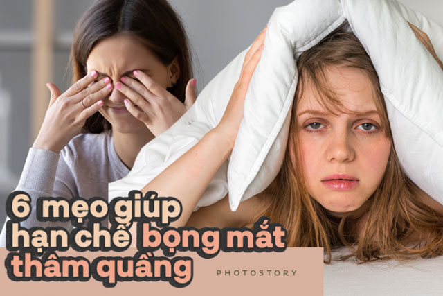 Mẹo giúp bạn đánh tan những vết thâm quầng quanh mắt