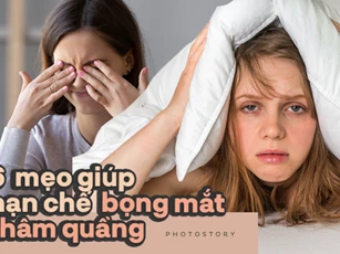 Mẹo giúp bạn đánh tan những vết thâm quầng quanh mắt
