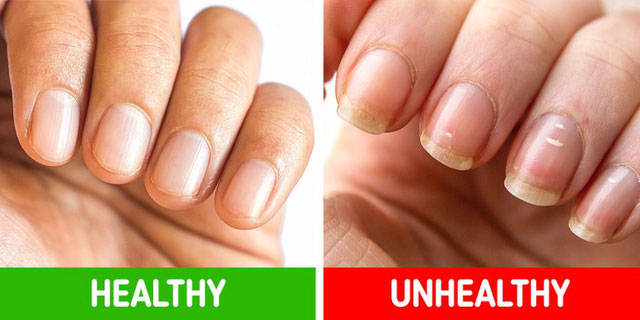 8 “dấu hiệu” bệnh tật nguy hiểm mà chúng ta thường bỏ qua