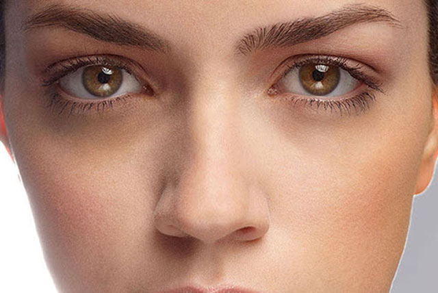 2 cách chữa thâm mắt đơn giản có thể bạn chưa biết