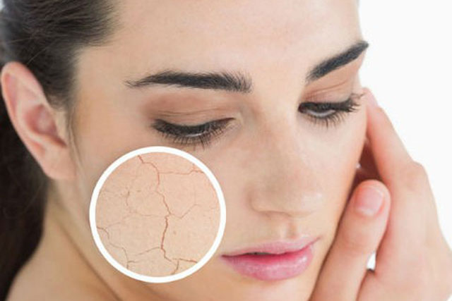 Bí quyết để da không khô, nứt nẻ ngày hanh khô