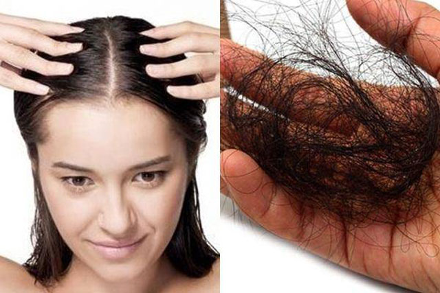 Những thói quen gây rụng tóc, hói đầu
