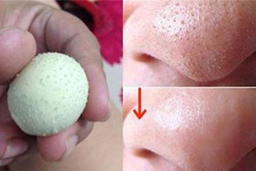 Sạch mụn đầu đen chỉ bằng cách dùng trứng gà