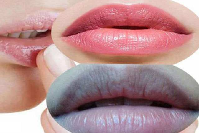 3 cách khắc phục tình trạng môi thâm tại nhà