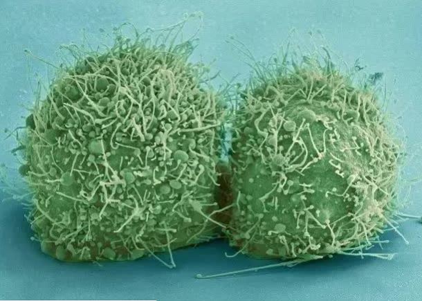 Tế bào ung thư này đã được nuôi dưỡng suốt 70 năm, riêng khối lượng thu về đã hơn 50 triệu tấn