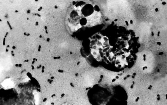 Giải mã được bí ẩn 700 năm về nguồn gốc Cái chết Đen