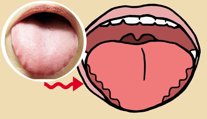 Dấu hiệu cảnh bảo sức khỏe bạn phải đi khám ngay