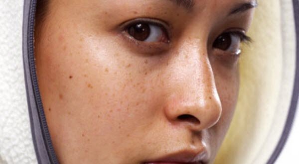 Lý do khiến làn da ngày càng thâm sạm, xỉn màu