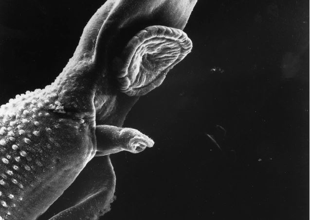 Những loài ký sinh trùng nguy hiểm nhất ở người từng được phát hiện