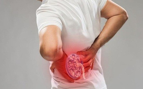 Nguyên nhân không ngờ khiến bạn bị bệnh sỏi thận