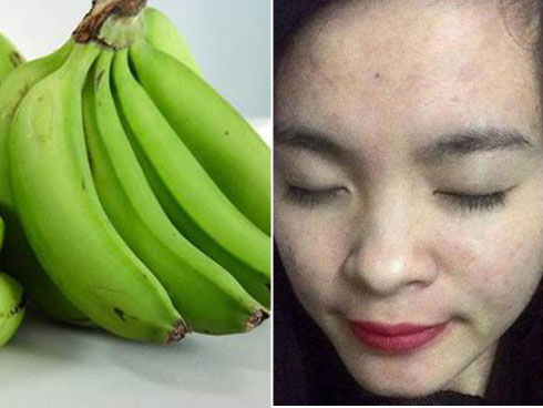Công thức làm trắng da, sạch mụn tiết kiệm với chuối xanh