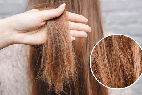 Nguyên nhân khiến tóc bạn ngày càng xơ xác