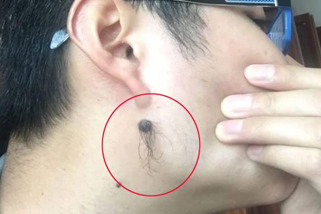 Các cụ dạy "4 vị trí lông mọc nhiều thì phát tài, phú quý tìm đến, ôm hết lộc thiên hạ về nhà"