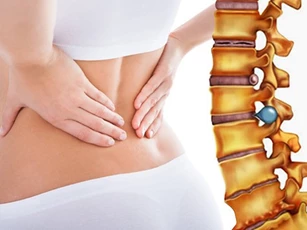 3 dấu hiệu cảnh báo bạn bị thoát vị đĩa đệm