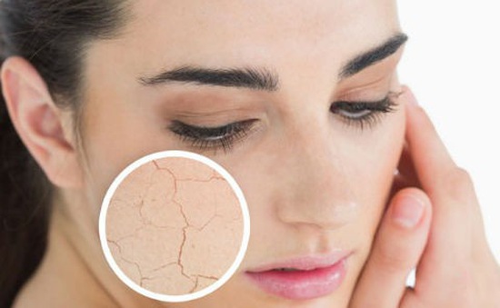 Dấu hiệu cơ thể đang thiếu vitamin C cần bổ sung ngay