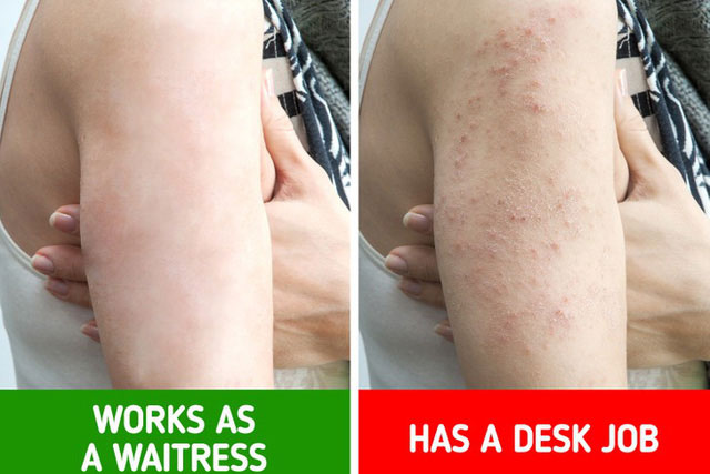 Điều gì xảy ra với cơ thể nếu ngồi quá nhiều?