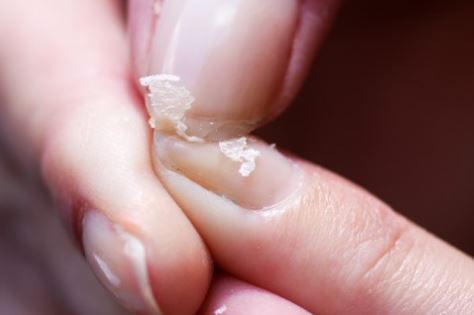 5 lý do bạn nên giảm lượng muối ngay hôm nay