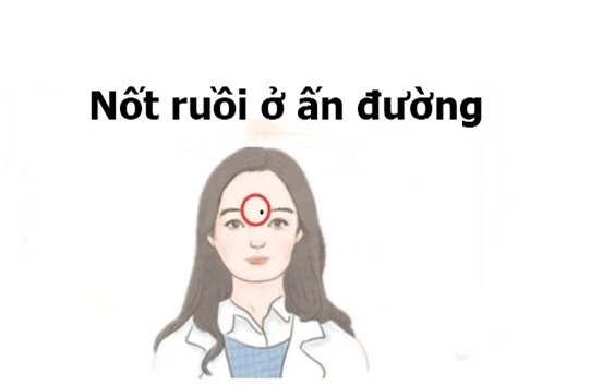 not-ruoi-vuong-tuong-02