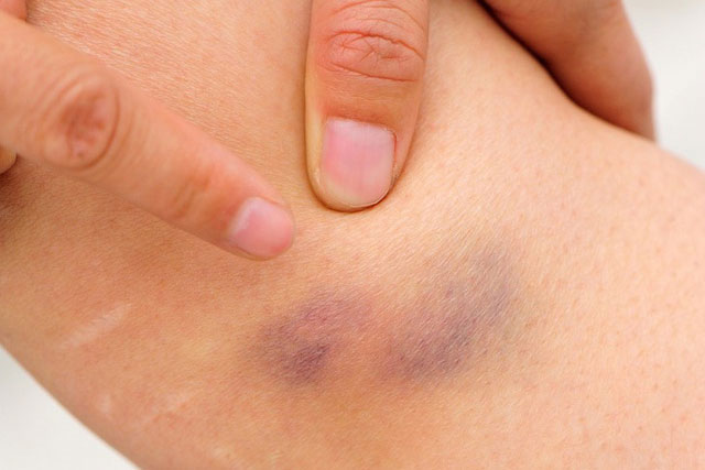 Những dấu hiệu bất thường của cơ thể mà bạn không nên bỏ qua