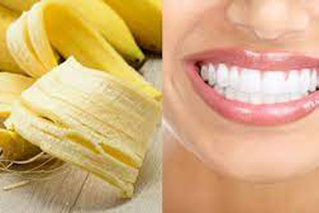 Chuối ăn xong đừng vứt vỏ đi: Làm theo cách này tẩy răng trắng tinh, lại an toàn