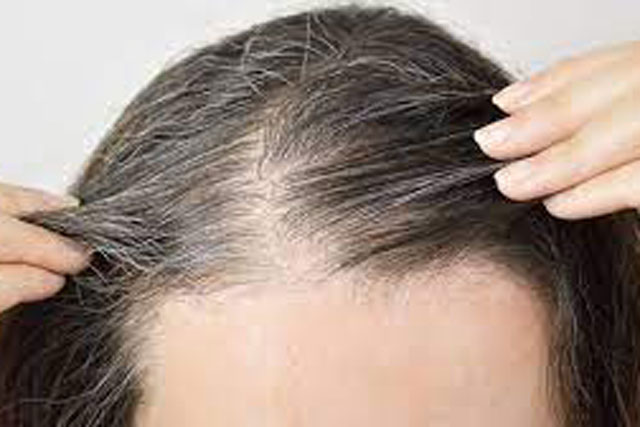 Nhổ tóc bạc 'tưởng không hại nhưng hại không tưởng': BS cảnh báo 5 nguy cơ có thể gặp phải, ai cũng cần biết