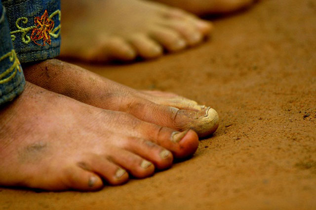 Bác sĩ nhắc nhở: 4 lý do tuyệt đối không được đi chân đất, kể cả đang trong nhà