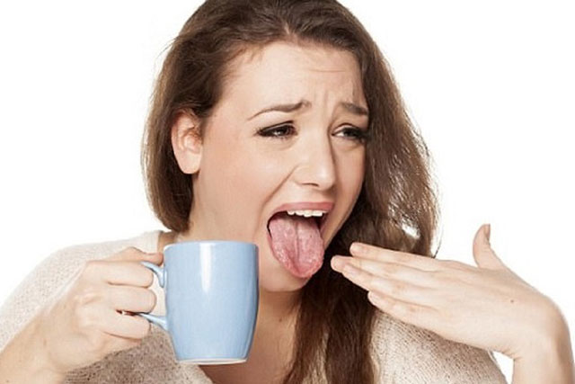 Sơ ý nếm phải đồ quá nóng khiến lưỡi bỏng rát? Chỉ với mẹo đơn giản sau, cơn rát của bạn sẽ giảm đi nhanh chóng