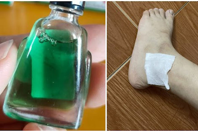 Lý do luôn cần 1 lọ dầu gió đặt đầu giường bất kể mùa đông hay hè: Trị được 7 bệnh nhiều người gặp