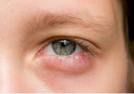 Dấu hiệu trên cơ thể cảnh báo bạn đang thiếu vitamin